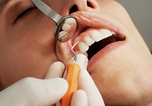 What is the Difference Between an Emergency Dentist and a Regular Dentist?